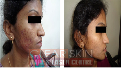 Clear Skin Hair and Laser Centre