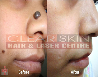 Clear Skin Hair and Laser Centre