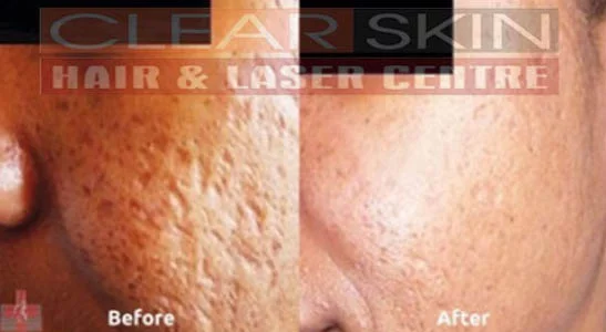 Clear Skin Hair and Laser Centre