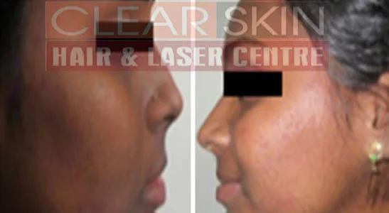 Clear Skin Hair and Laser Centre