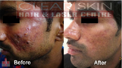 Clear Skin Hair and Laser Centre