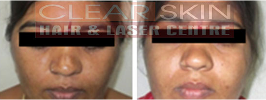 Clear Skin Hair and Laser Centre