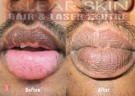 Clear Skin Hair and Laser Centre