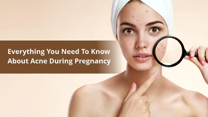 Know Everything About Acne and Pregnancy