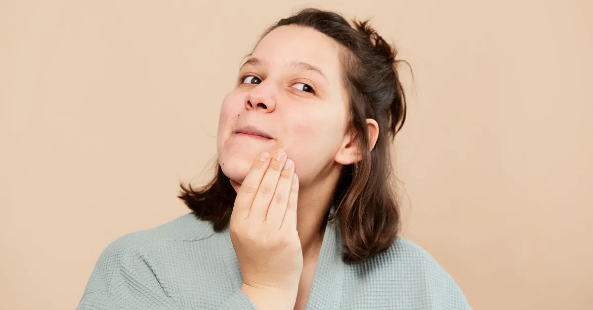 Know about the acne flare-ups during menstruation