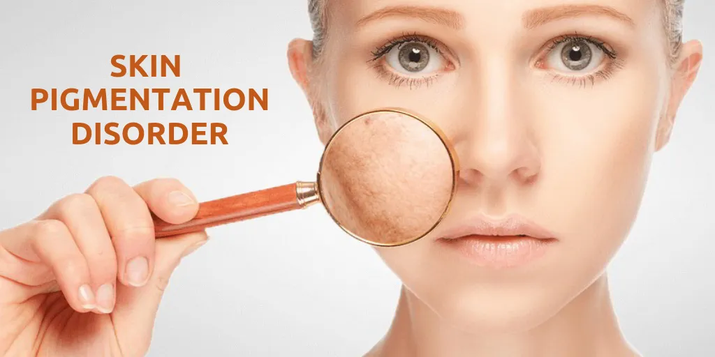 Skin pigmentation disorders