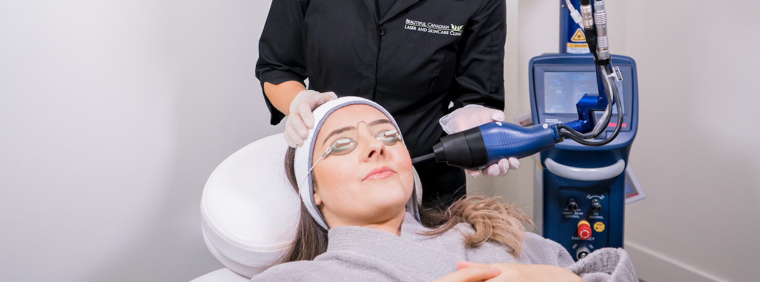 FRACTIONAL CO2 LASER-SELLAS CO2