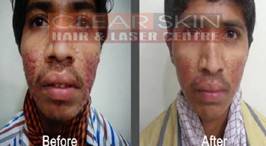 Clear Skin Hair and Laser Centre