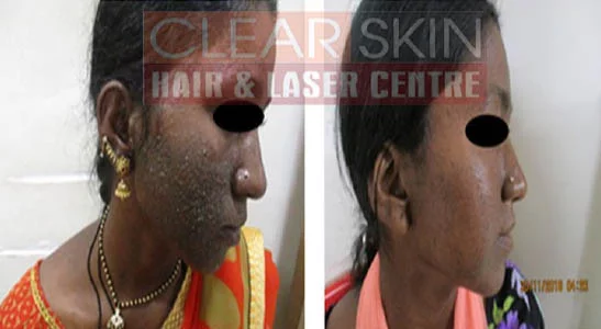 Clear Skin Hair and Laser Centre