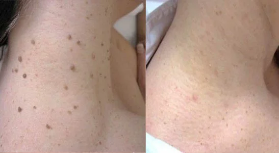 Clear Skin Hair and Laser Centre