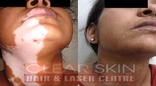 Clear Skin Hair and Laser Centre